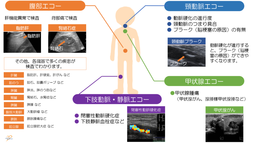 心臓・腹部・頸動脈・甲状腺などの超音波検査、睡眠時無呼吸検査 